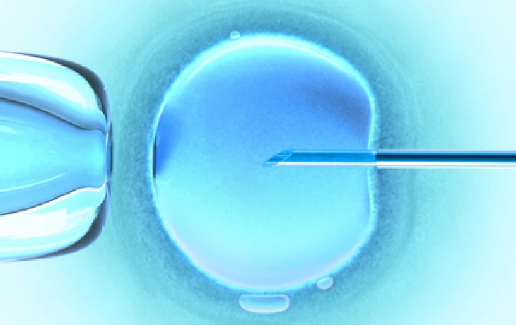 Jak probíhá umělé oplodnění: IVF krok za krokem